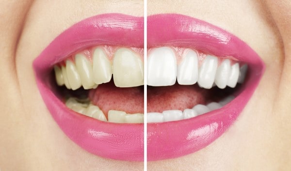 What Early Signs of Oral Cancer Should You Never Ignore Bath?