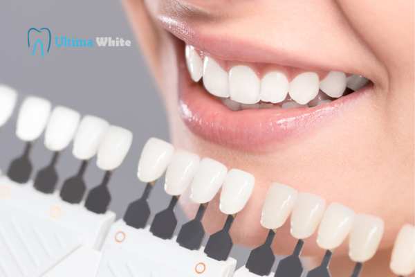 How to Maximise the Results of Your Laser Teeth Whitening Treatment Bath