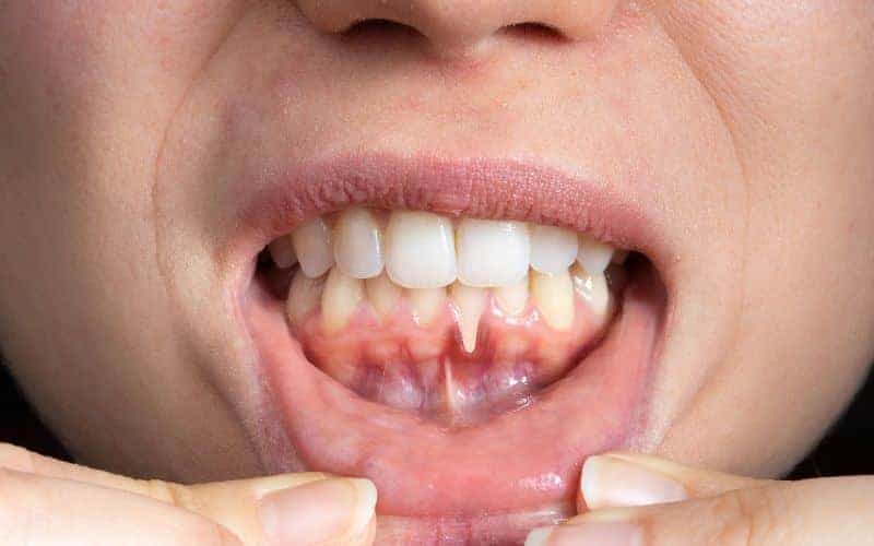 Final Thoughts: Building Lifelong Enamel Protection Habits Bath