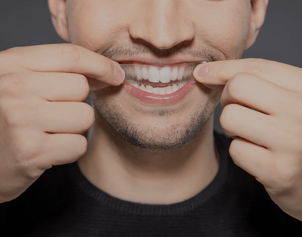 Can You Whiten Natural Teeth Without Harsh Chemicals Bath?