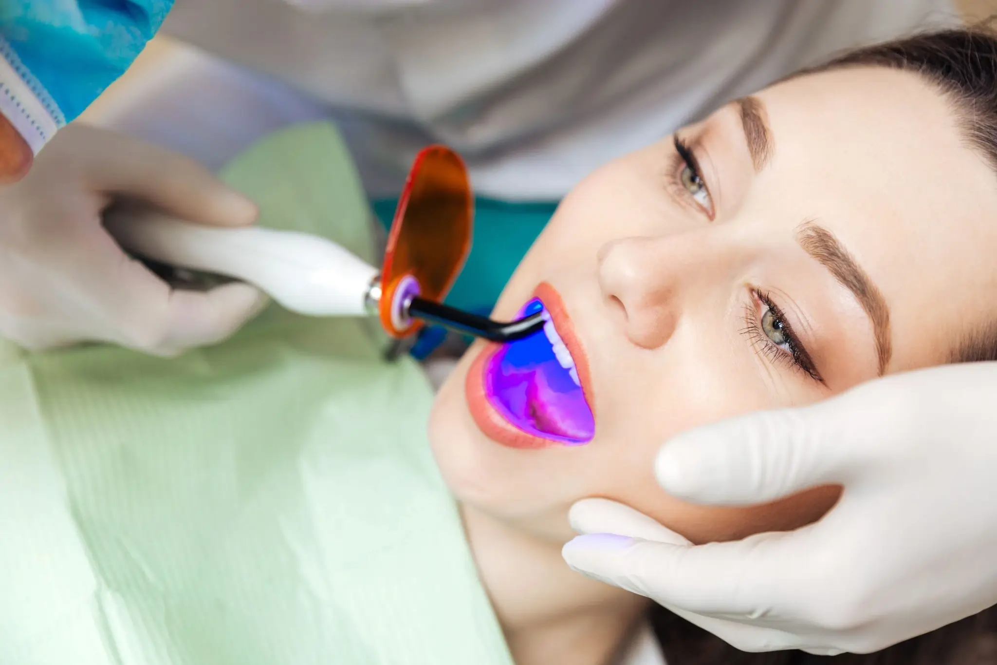 How Long Can You Expect Laser Teeth Whitening Results to Last Bath?