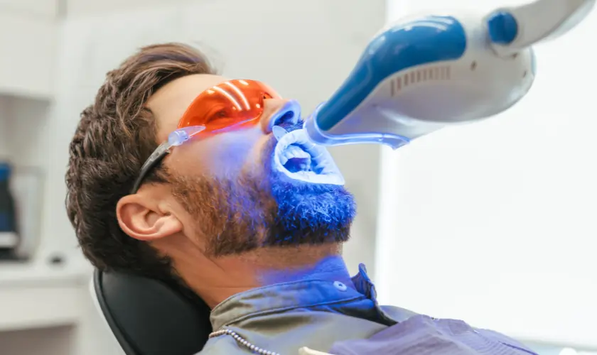 What Is Laser Teeth Whitening and How Does It Work Bath?