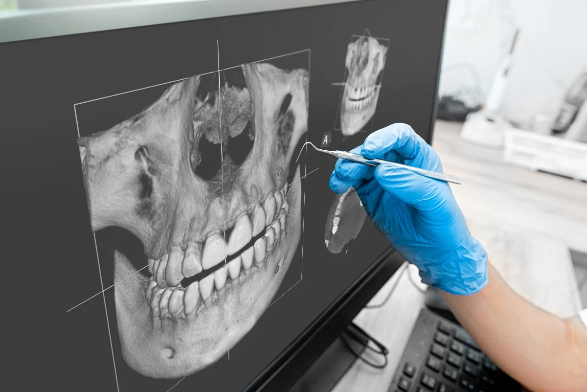 Key Benefits of 3D Printing for Patients and Dentists Bath