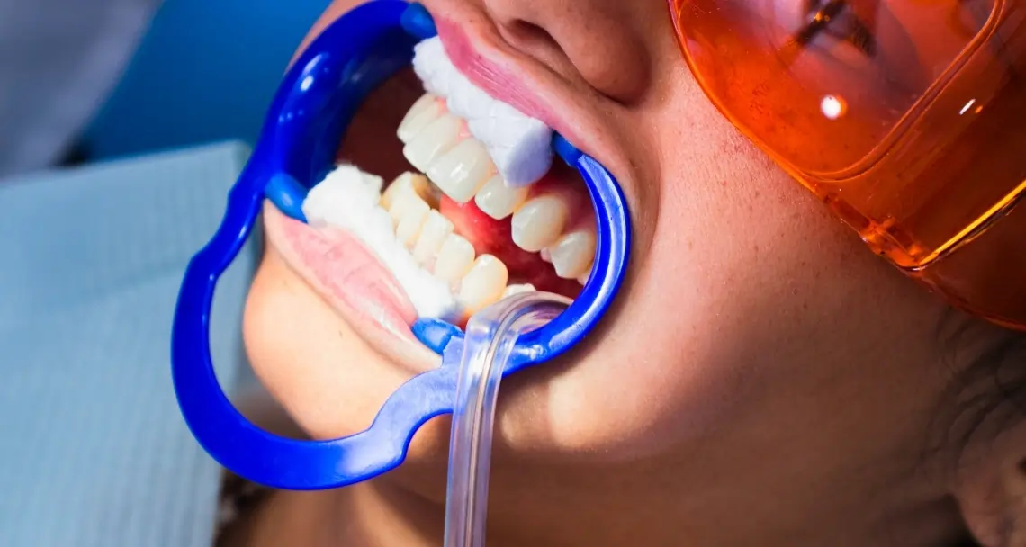 How Teeth Whitening Treatments Actually Work on Your Enamel Bath