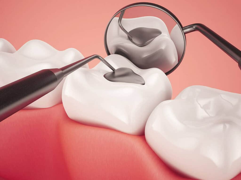 Fighting Cavities and Plaque Buildup Bath