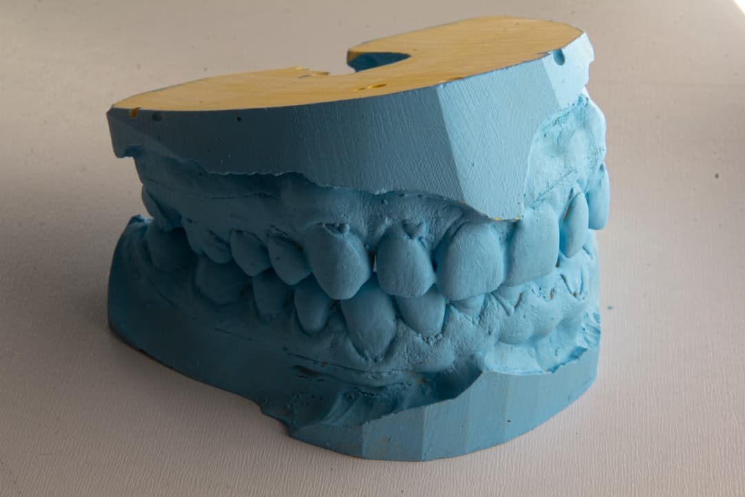 How Do Dental Implants Improve Jawbone Health and Oral Function Bath?