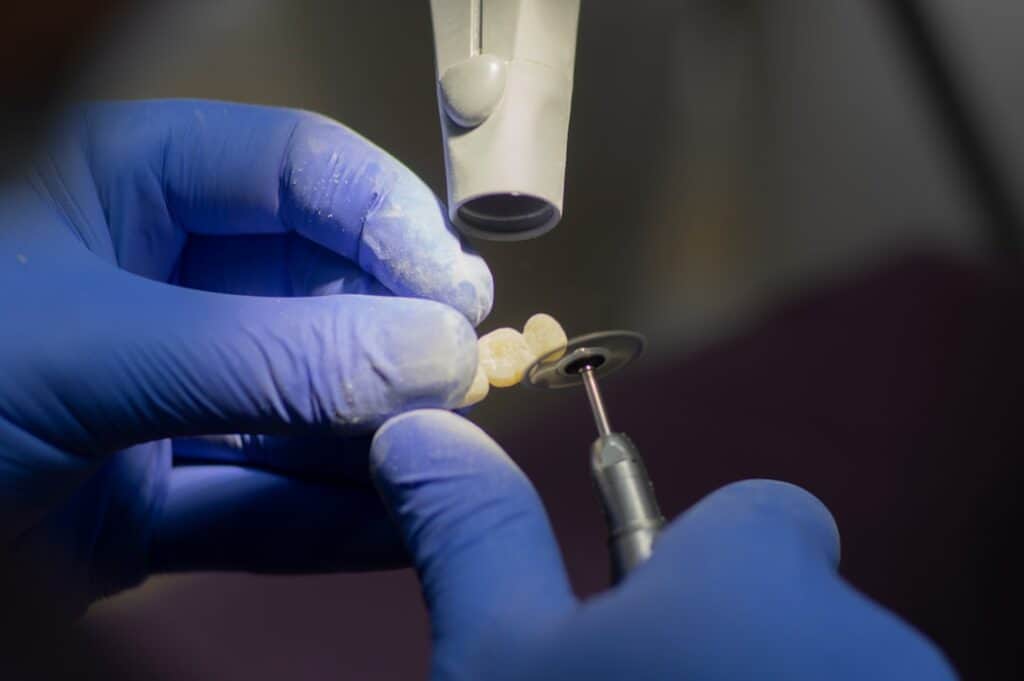 Customised Dental Solutions: Crowns, Aligners, and Implants Bath