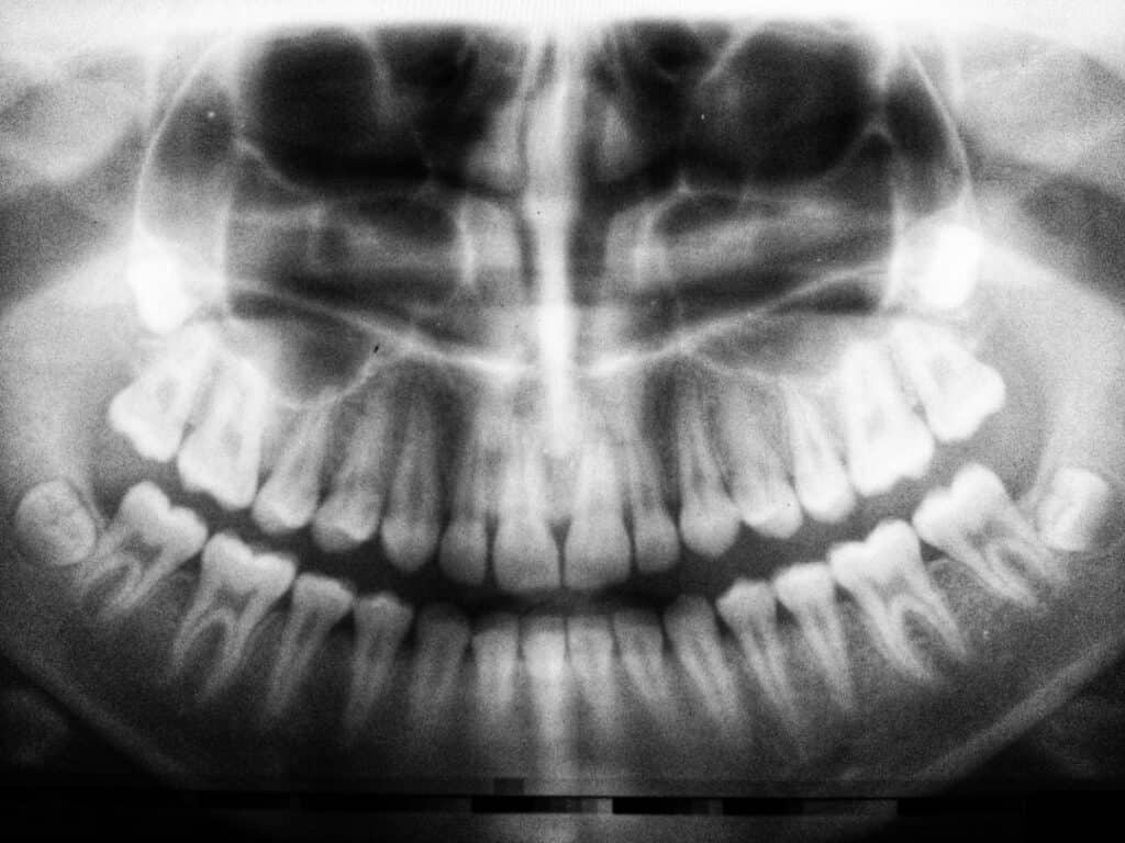 The Future of 3D Printing in Oral Healthcare Bath